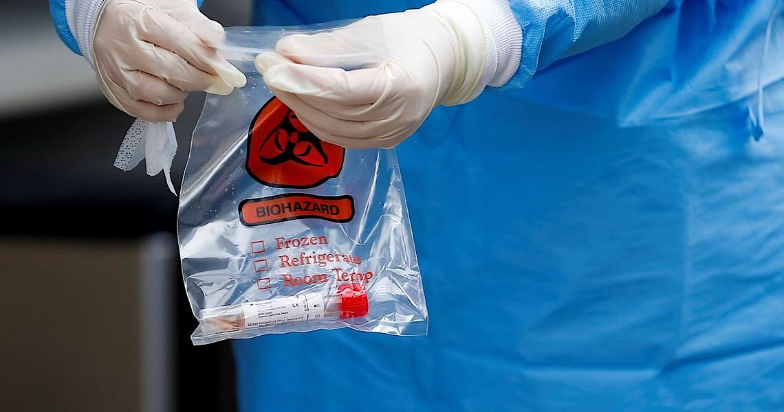 Brasil chega a 486 mortos e 11.130 casos de coronavírus