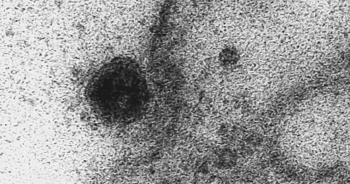 Coronavírus: Brasil tem 2.575 mortes e 40.581 casos confirmados