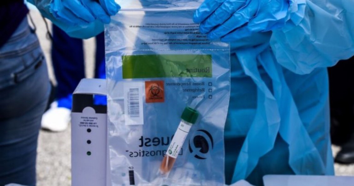 Servidores públicos que atuarem na pandemia terão de passar por testes de coronavírus a cada 15 dias
