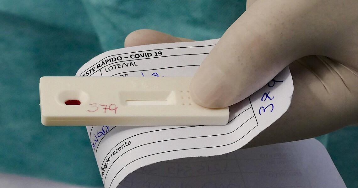 Chega a 1.537 número de infectados pelo coronavírus no DF. 871 pessoas estão recuperadas