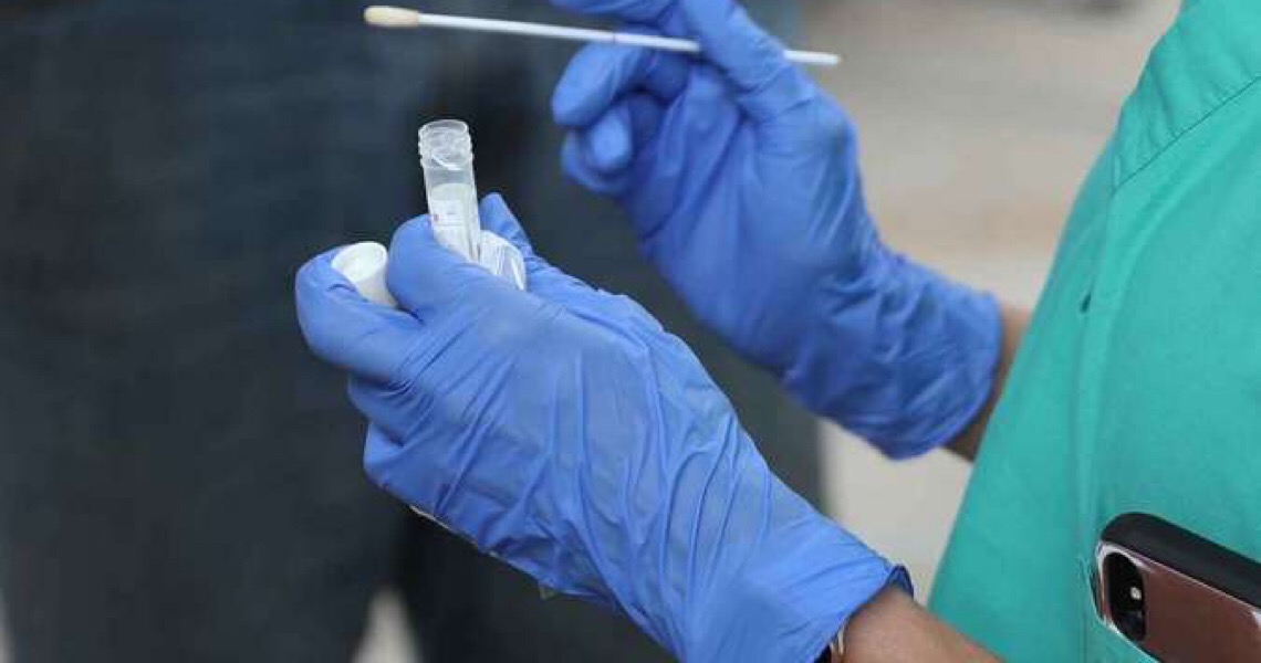 Justiça derruba decisão que obrigava plano de saúde a cobrir exame de covid