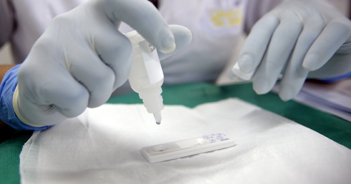 Ministério da Saúde tem 9,8 milhões de testes parados por falta de insumos