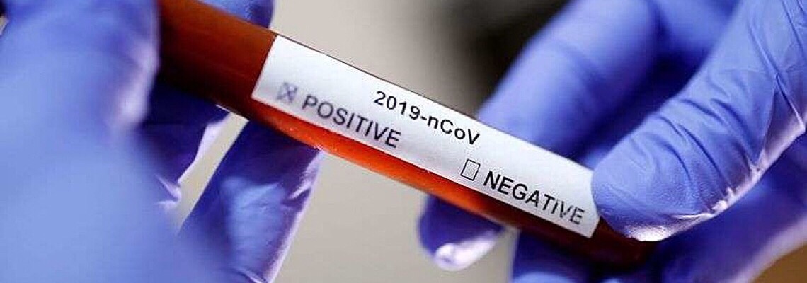 Brasil é o segundo país do mundo em mortes, mas apenas o 63º em testes para covid