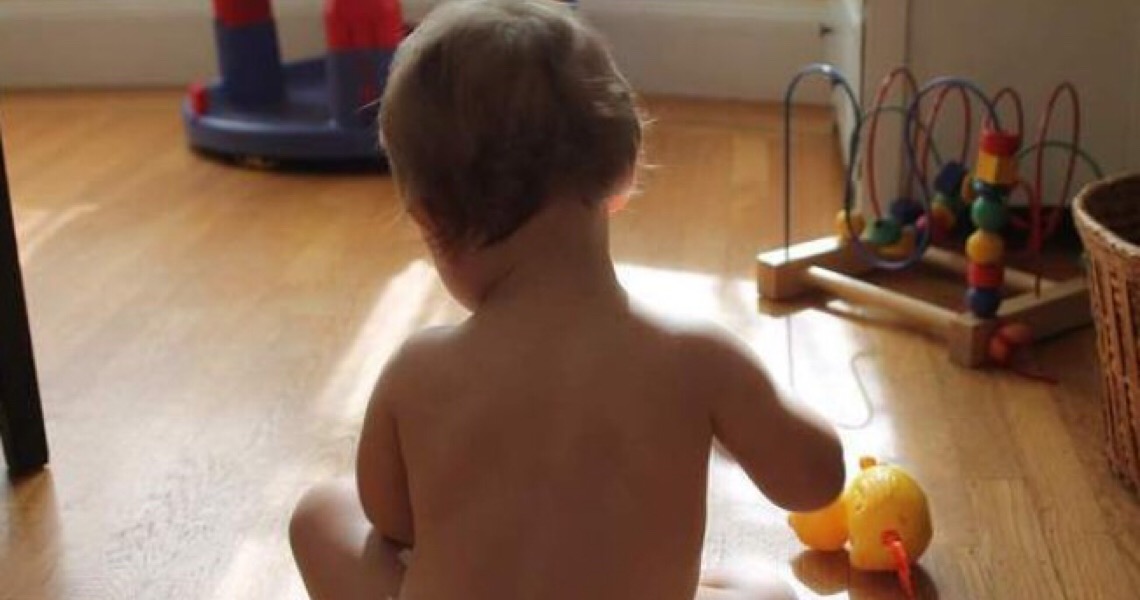 Como identificar a doença de Kawasaki em crianças que contraíram Covid-19?