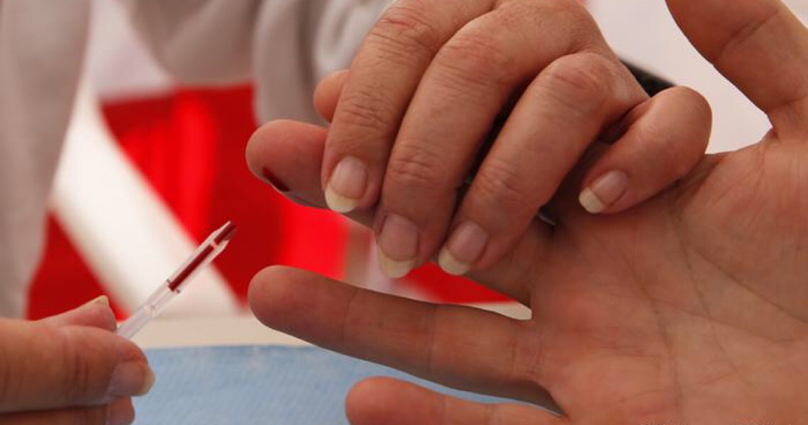 Como vai o combate à aids no Brasil?