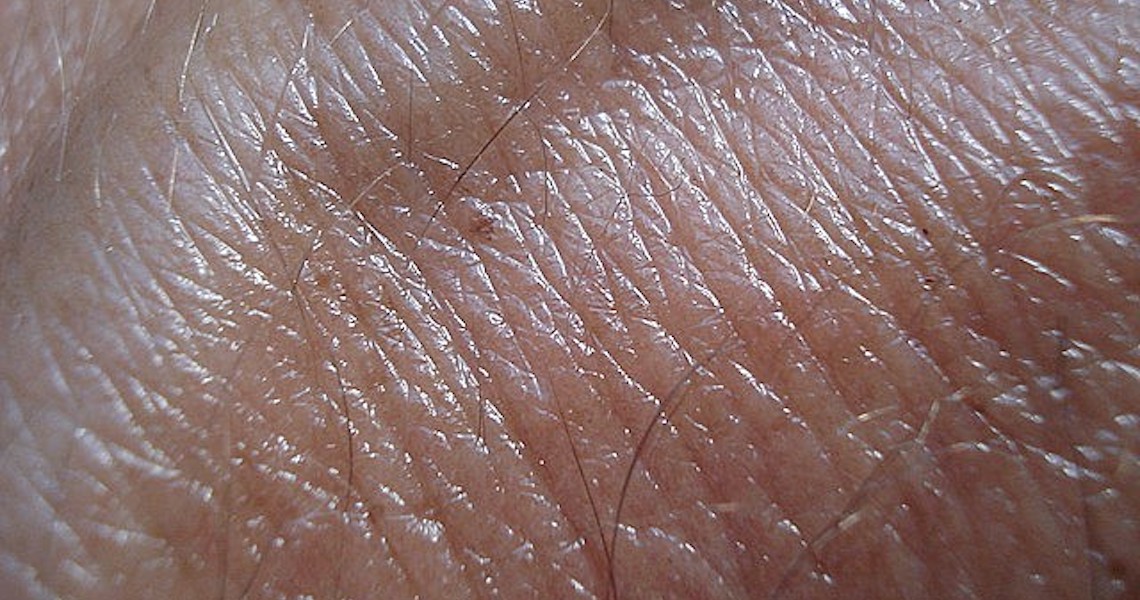 Biópsias para detectar câncer de pele caíram 48% na pandemia