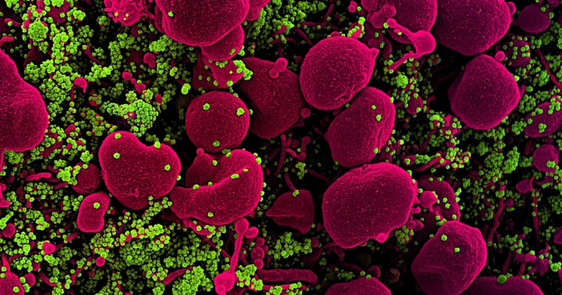 Brasil completa 20 dias com média de mortes por covid acima de mil