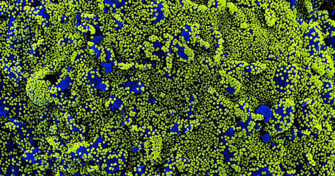 Fiocruz aponta que carga viral de nova cepa da covid pode ser até 10 vezes maior