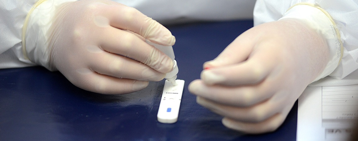 Com baixa testagem, Brasil sofre para monitorar pandemia de Covid-19