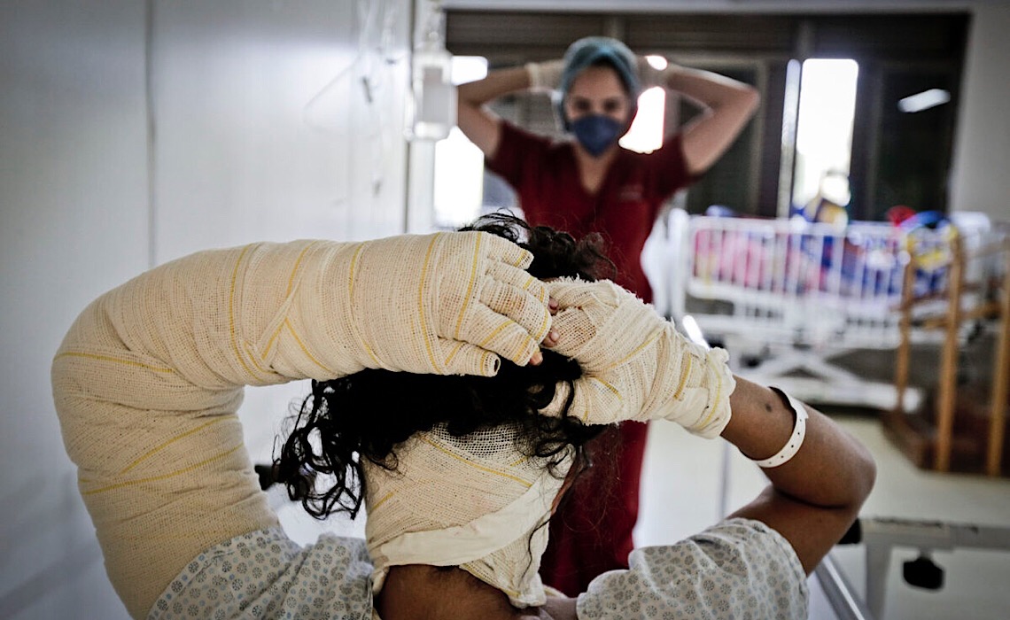 Junho Laranja destaca a conscientização e prevenção a queimaduras