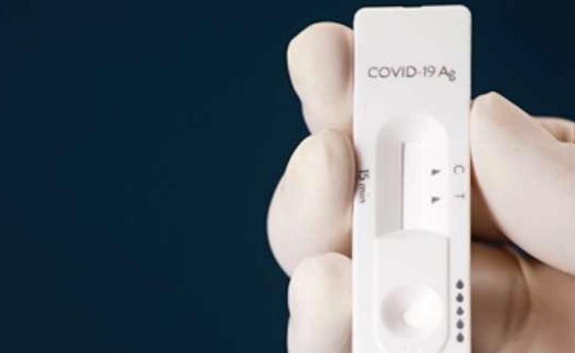 Testes rápidos de Covid-19: Fatores que causam alteração no resultado