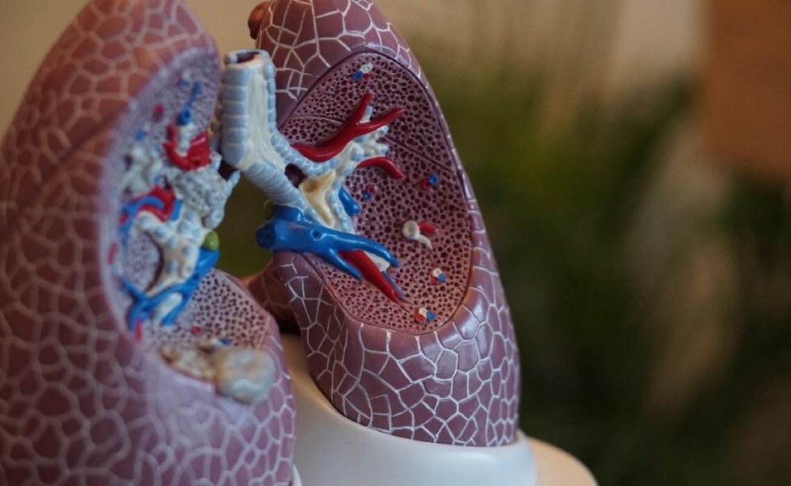 Pesquisa aponta para forma de tratamento da fibrose pulmonar