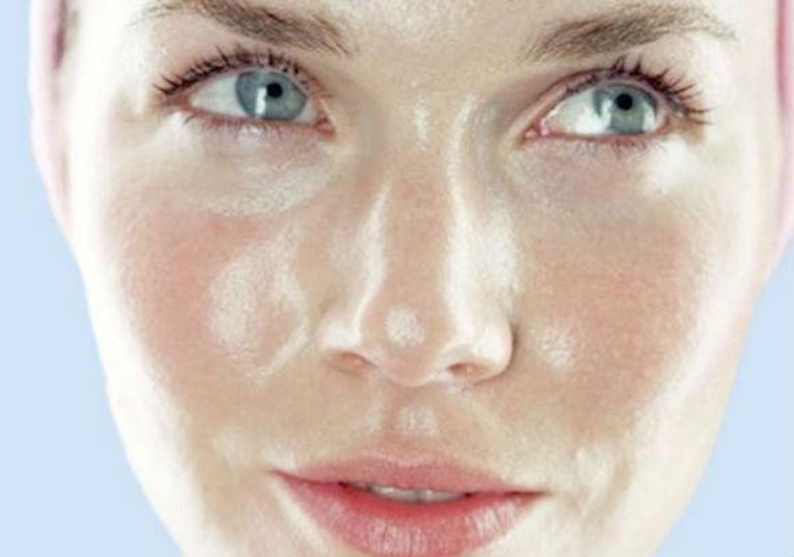 Conheça as causas do excesso de oleosidade da pele facial e os cuidados que se deve ter com a pele oleosa