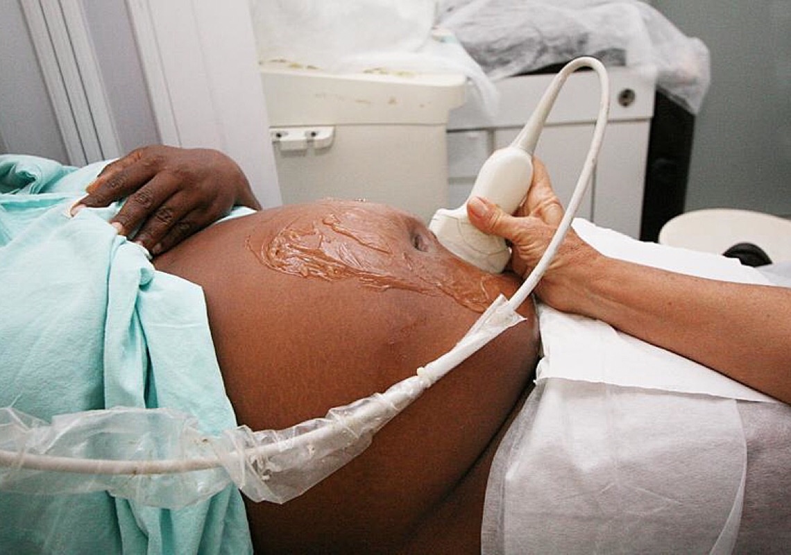 Racismo estrutural leva à maior mortalidade materna entre mulheres negras, aponta pesquisadora