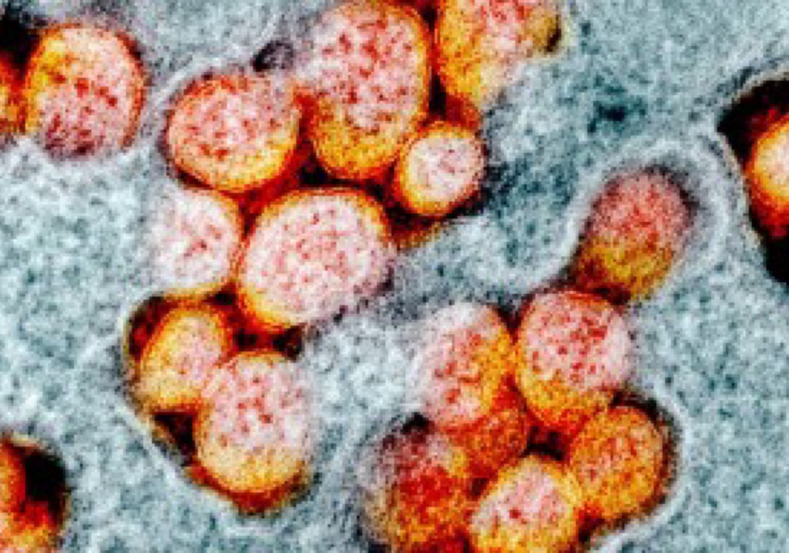 OMS diz que Ômicron é “bastante infecciosa”, mas não deve haver pânico