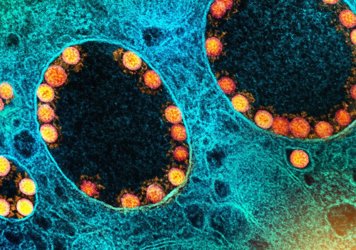 Ômicron: 3ª dose da AstraZeneca aumenta em 2,7 vezes anticorpos