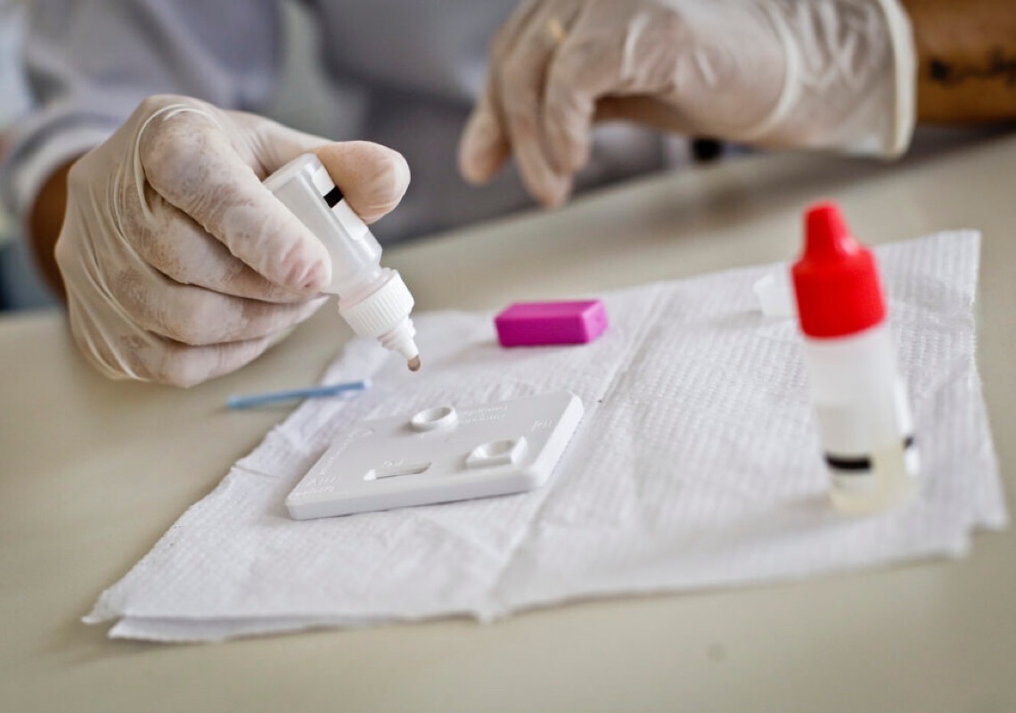 Prevenção ao HIV deve ser feita durante todo o ano