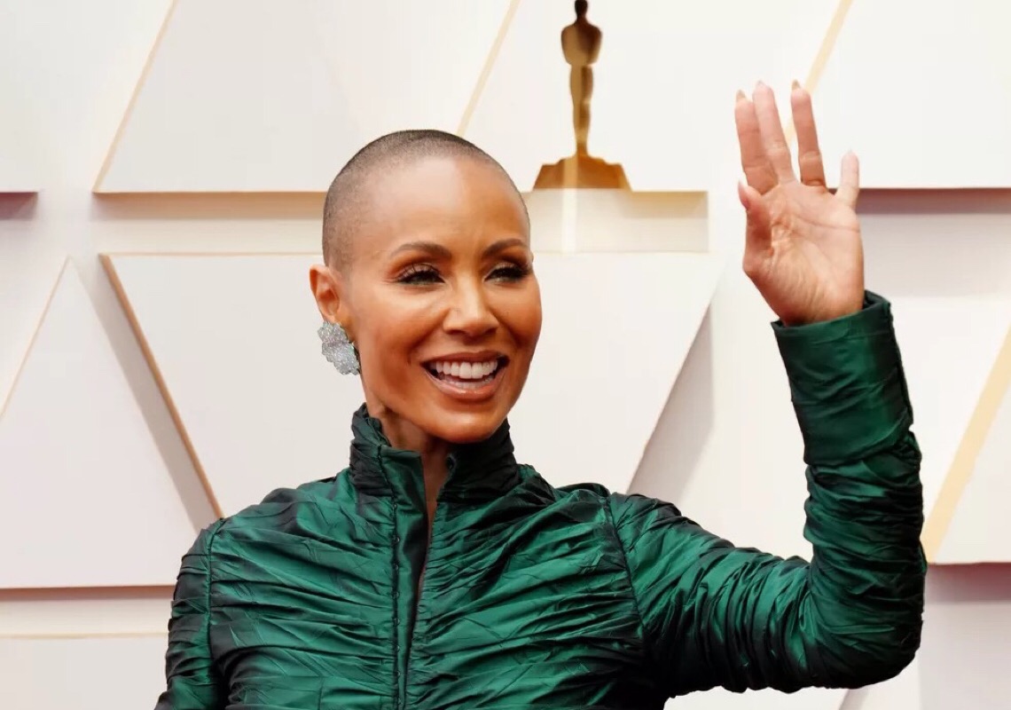 Jada Pinkett Smith: Entenda a doença Alopecia