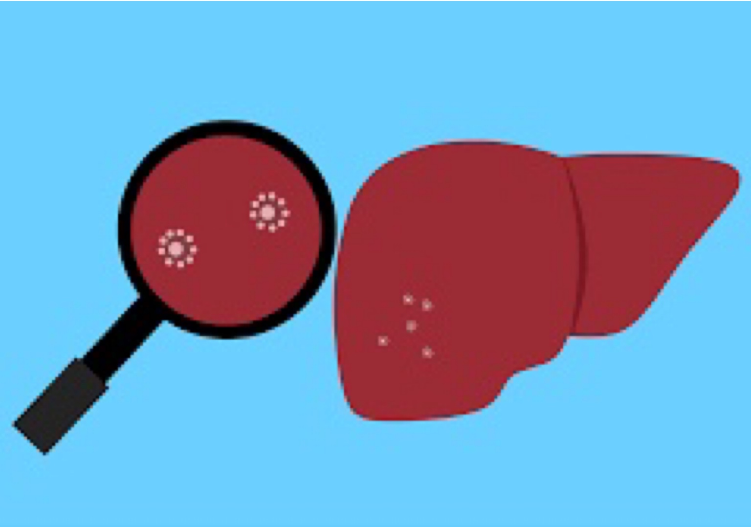 Hepatite infantil: O que se sabe sobre a doença que avança na Europa