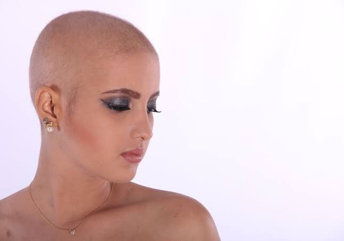 Dermatologista especialista em cabelos explica como tratar a calvície feminina