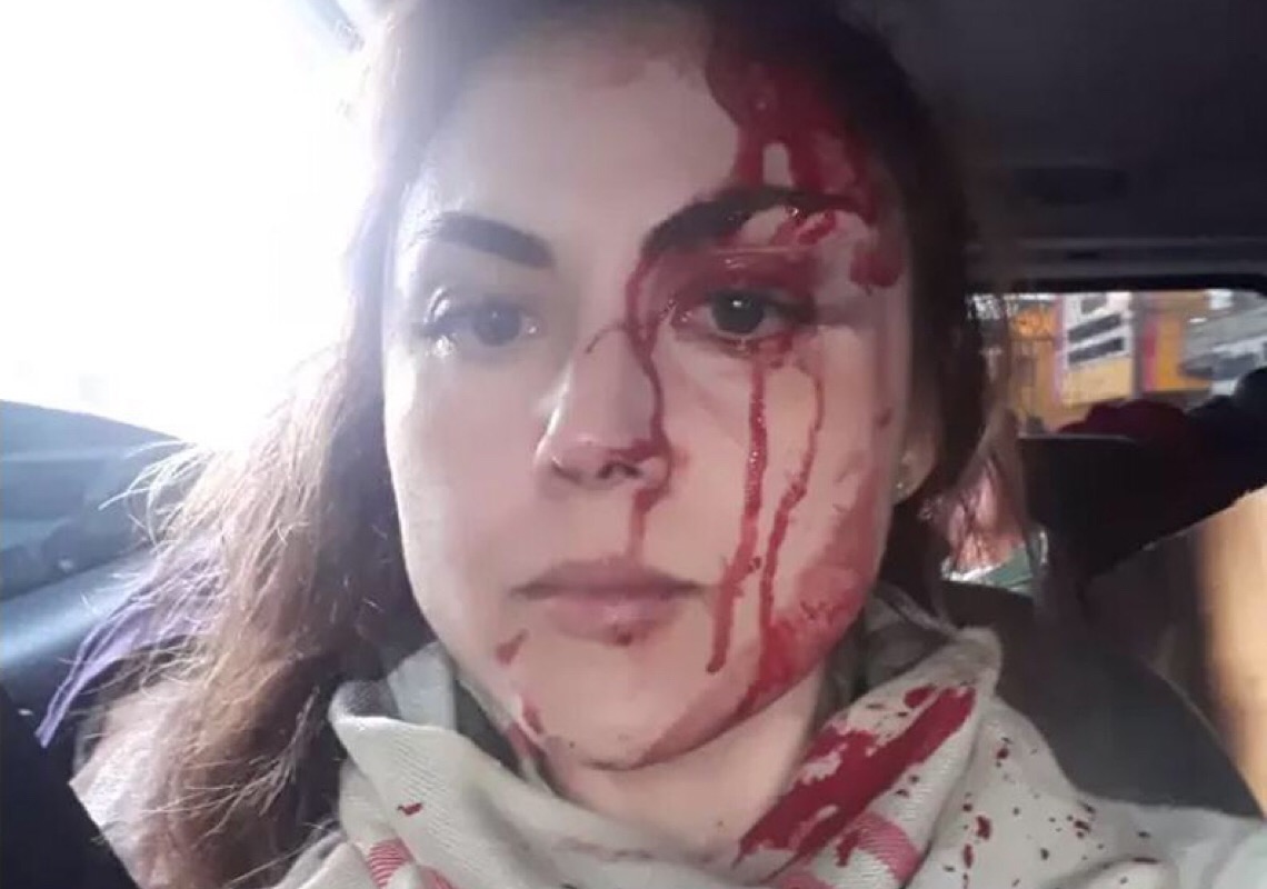 Polícia prende procurador que espancou a chefe em Registro