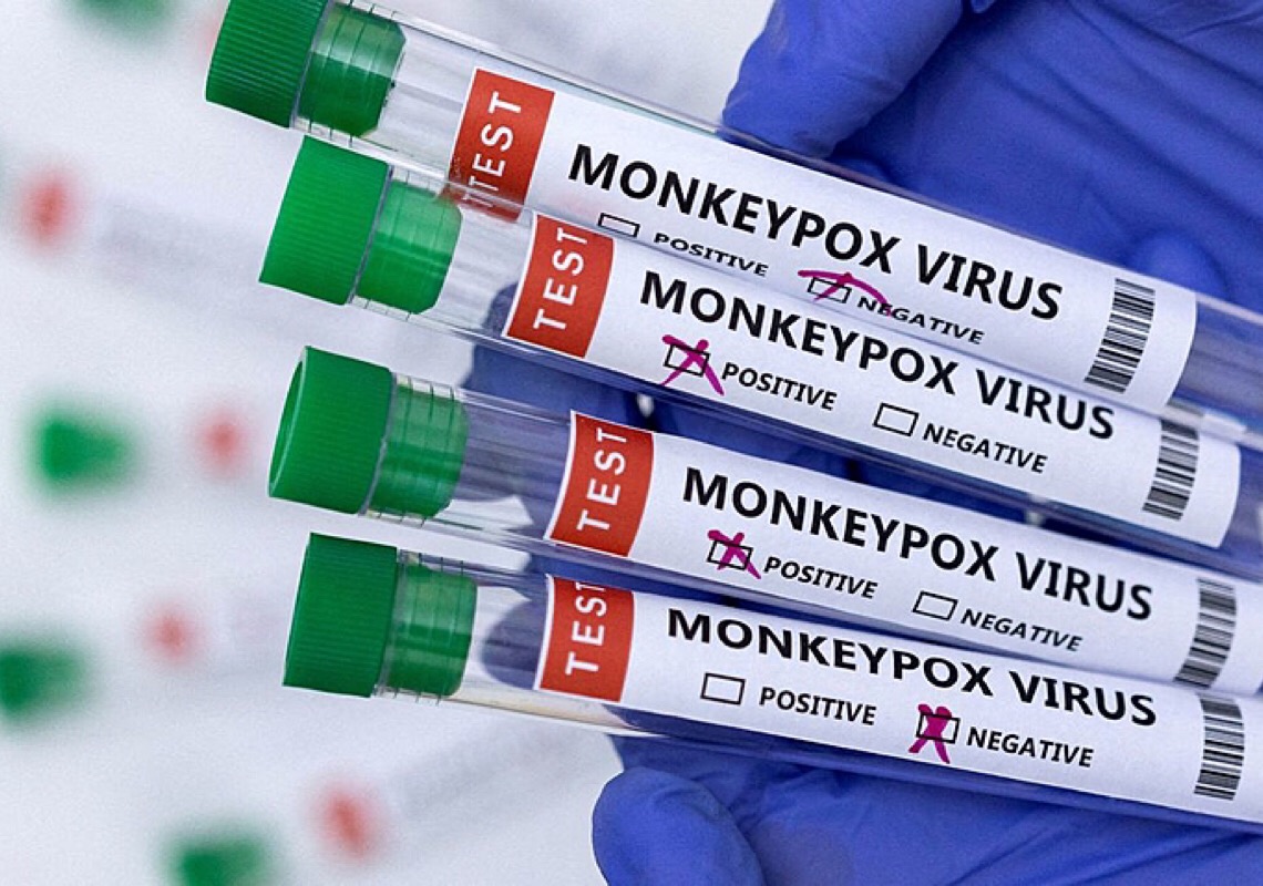 Monkeypox e homofobia: Movimentos alertam para que não se repitam os erros da pandemia da aids