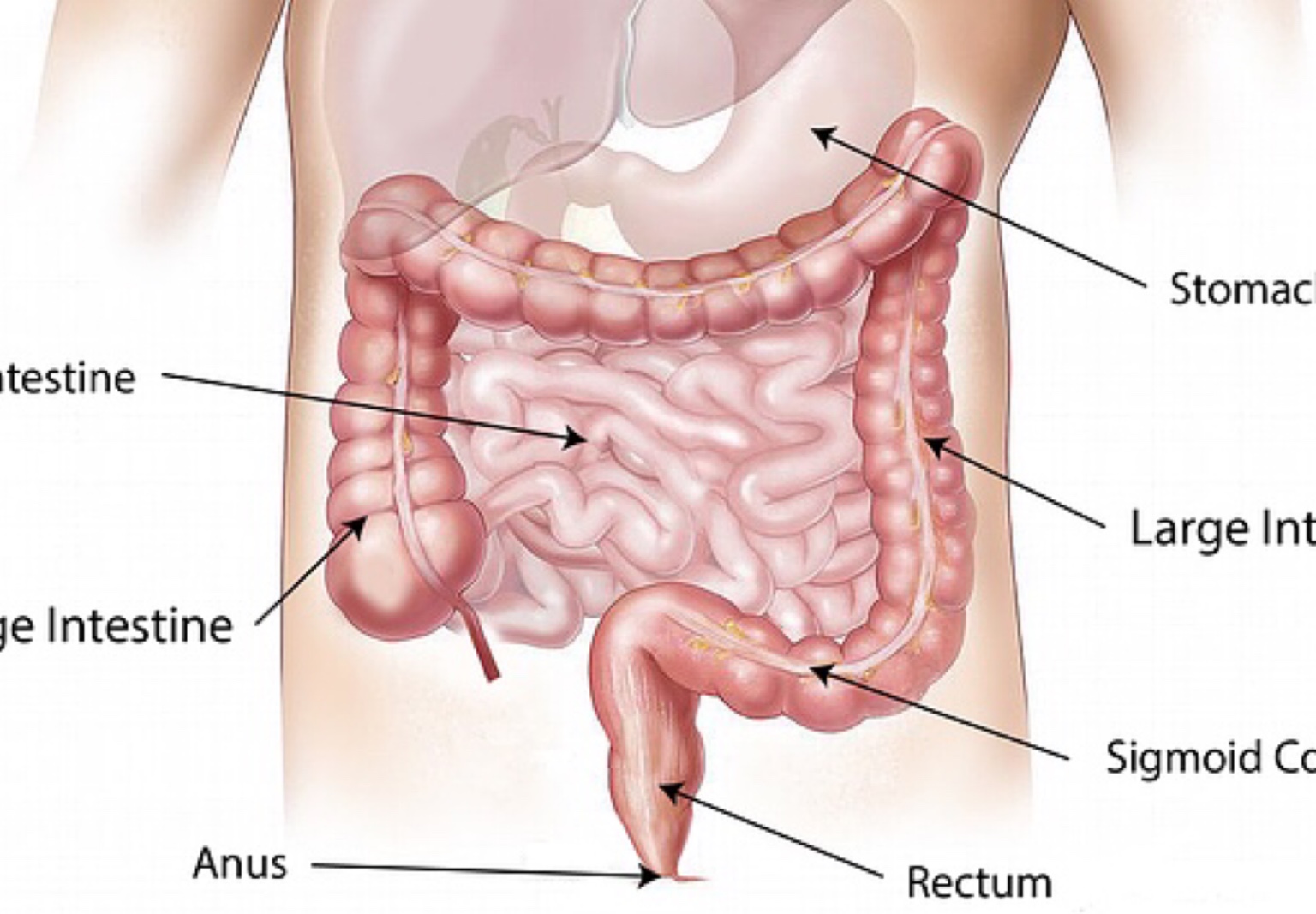 Câncer no canal anal: Médico oncologista explica mais sobre doença rara