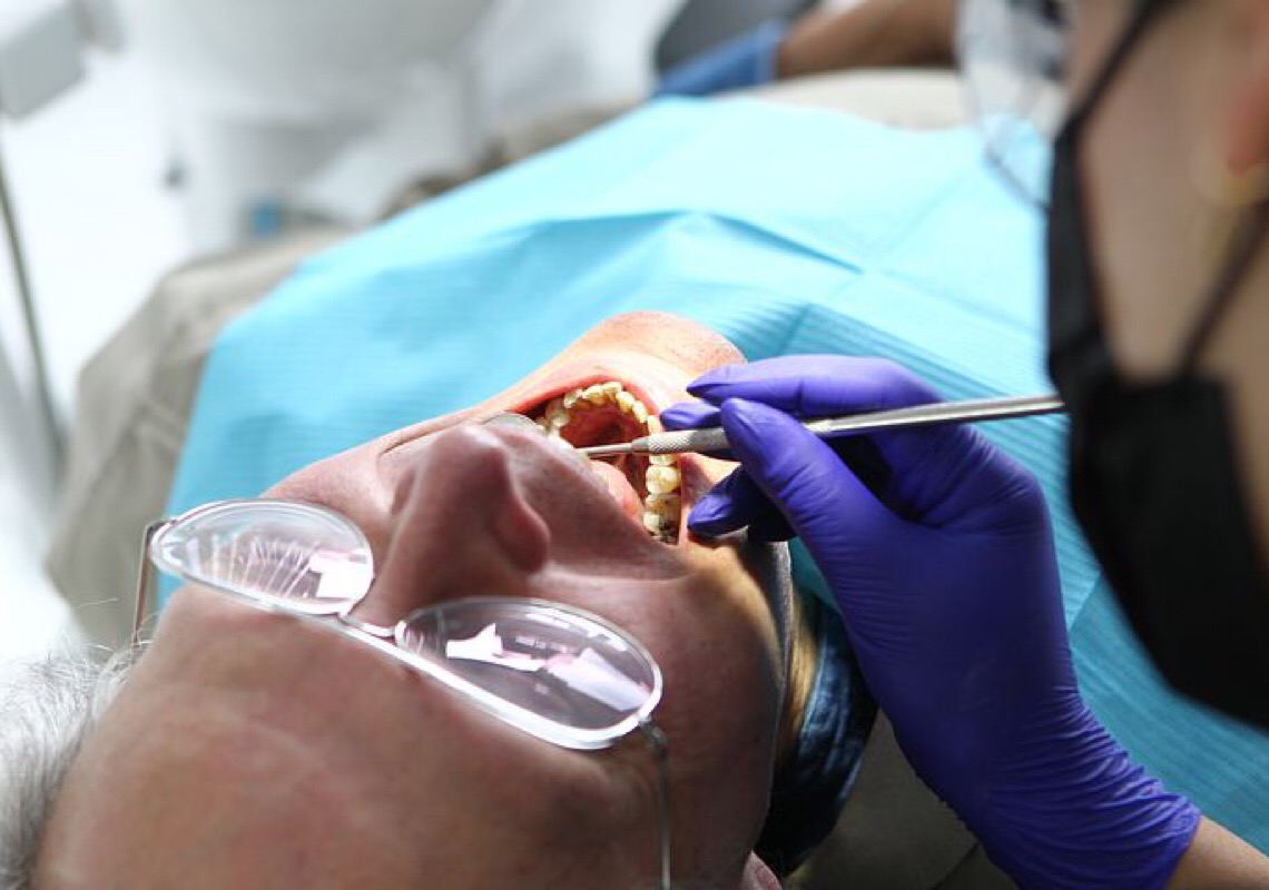 Clareamento dental é procedimento comum no Brasil e no mundo