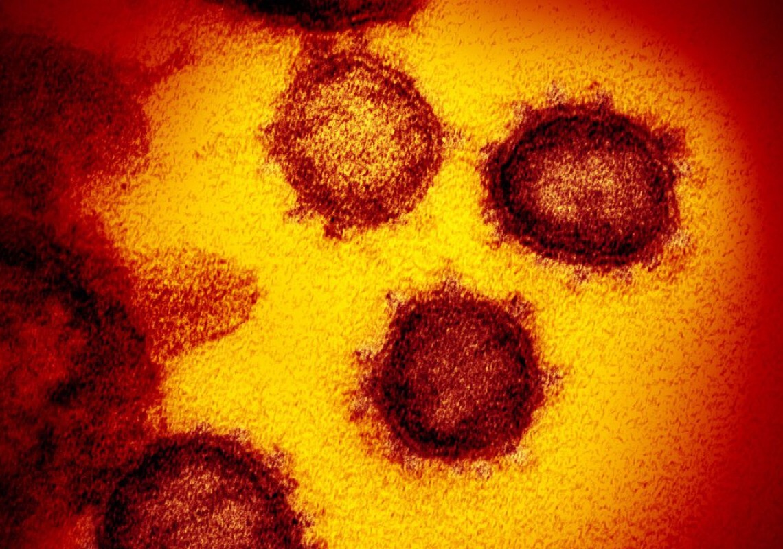 Fenômeno inédito: cientistas descobrem o 1º organismo que se alimenta apenas de vírus