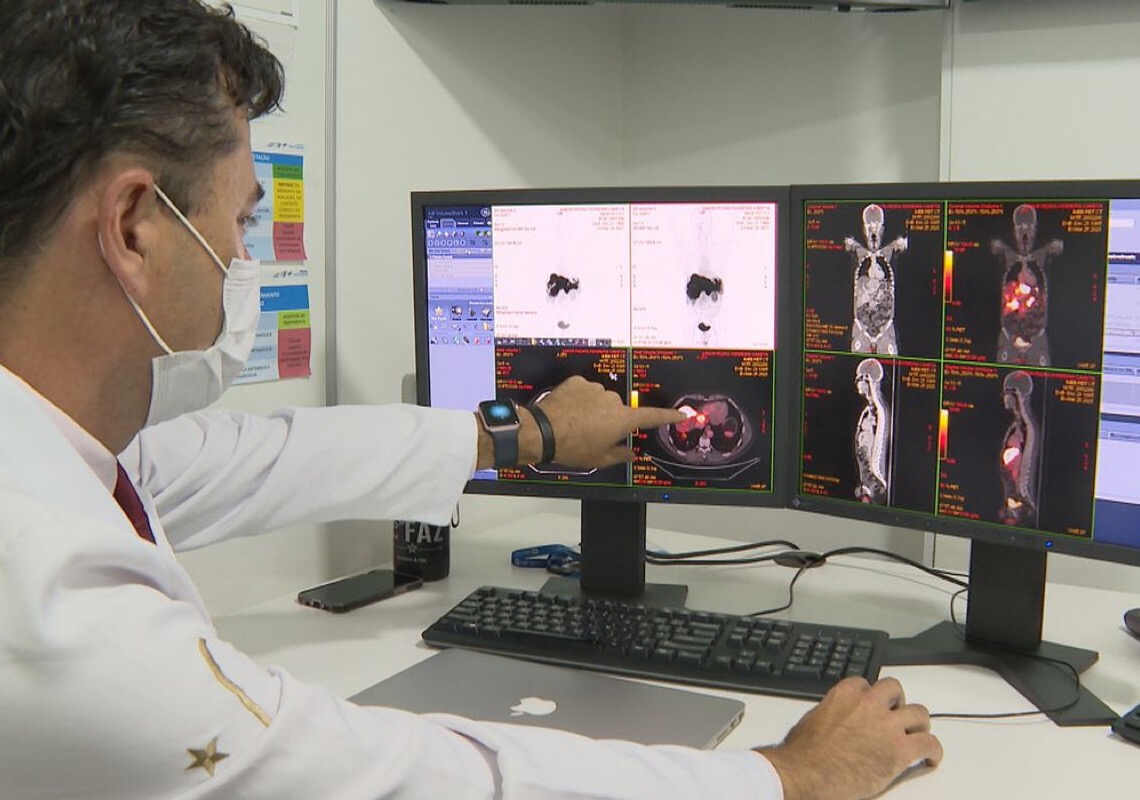 Inca prevê 44 mil casos novos de câncer colorretal no Brasil