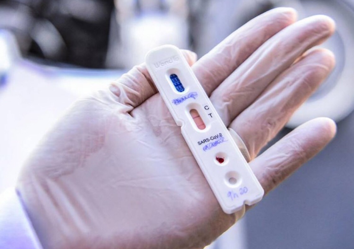 Três anos de pandemia: pacientes com covid longa e sequelas não conseguem tratamento no SUS