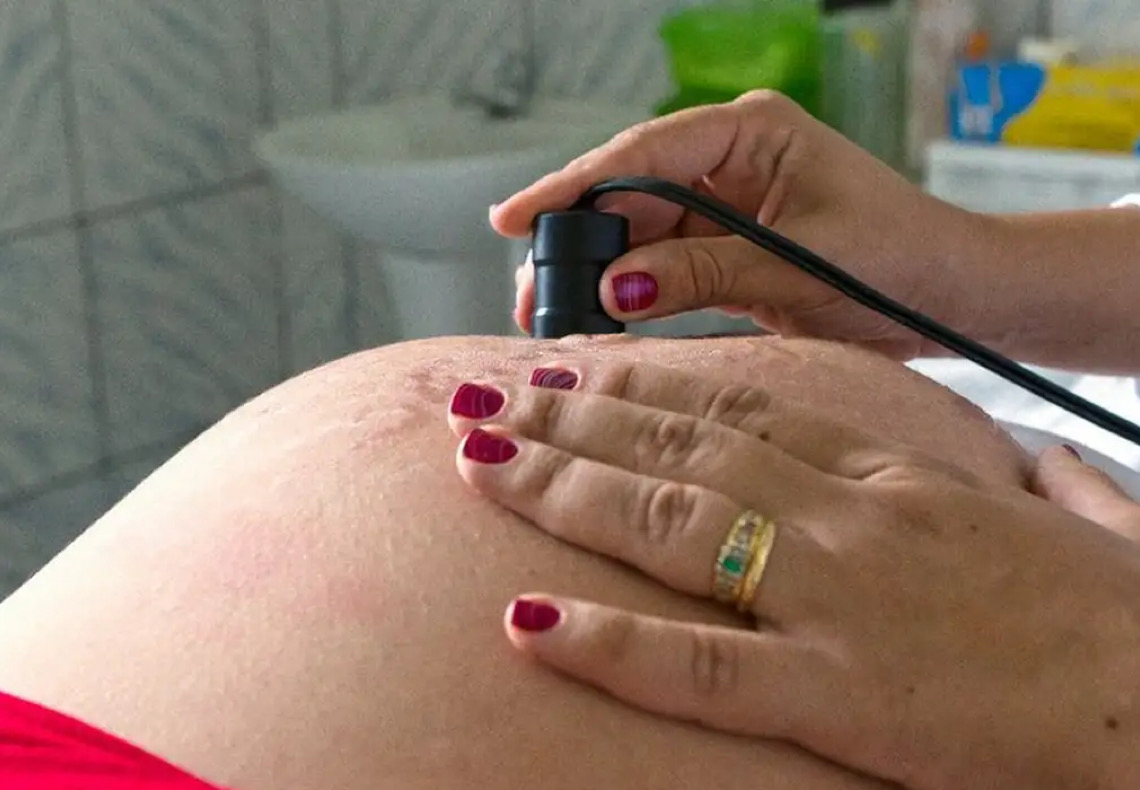 CFM tem 72 horas para explicar proibição de procedimento pré-aborto