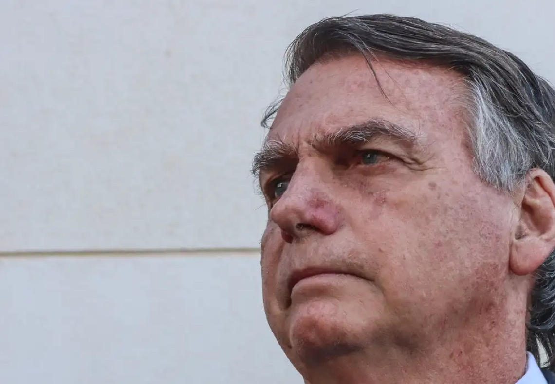 Saiba o que é erisipela, doença de pele que afeta Jair Bolsonaro
