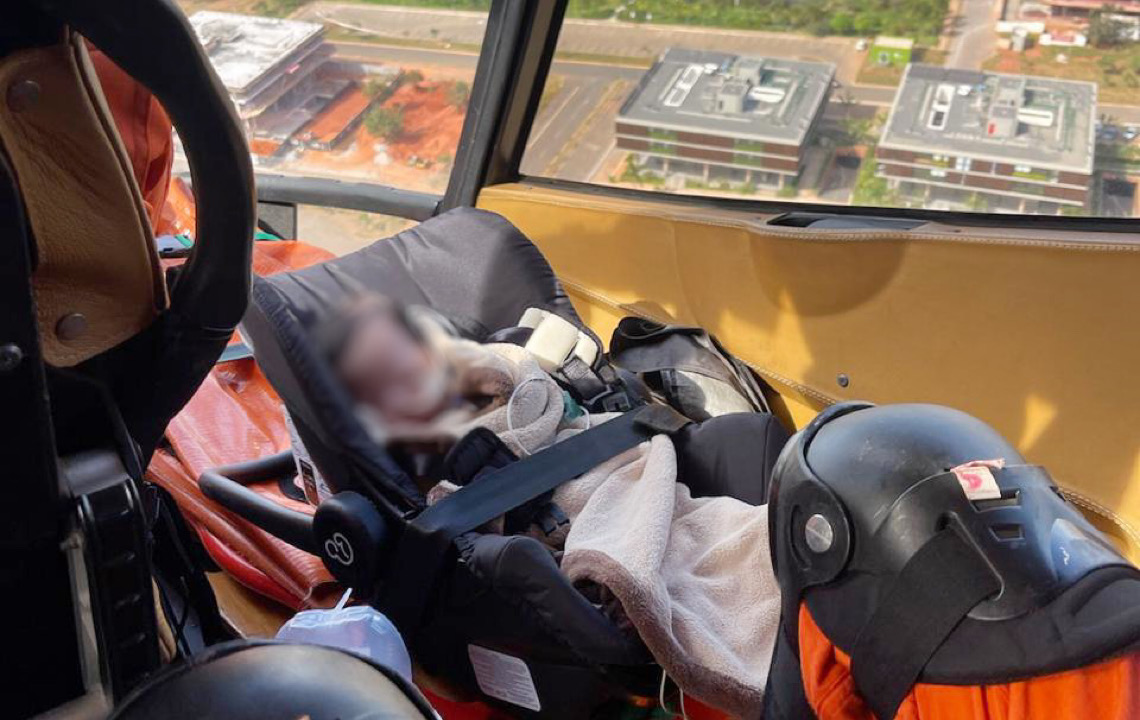 Articulação interfederativa garante transplante urgente de fígado a bebê de 2 meses do DF
