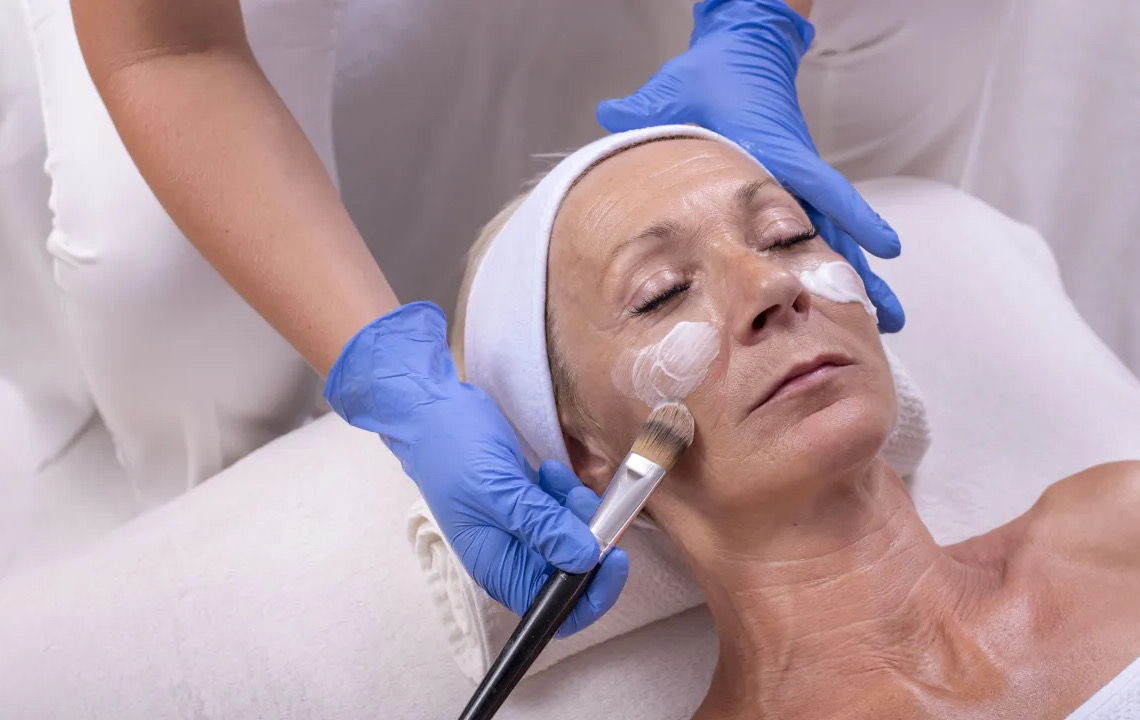 Peeling de fenol: saiba o que é e quais cuidados devem ser tomados