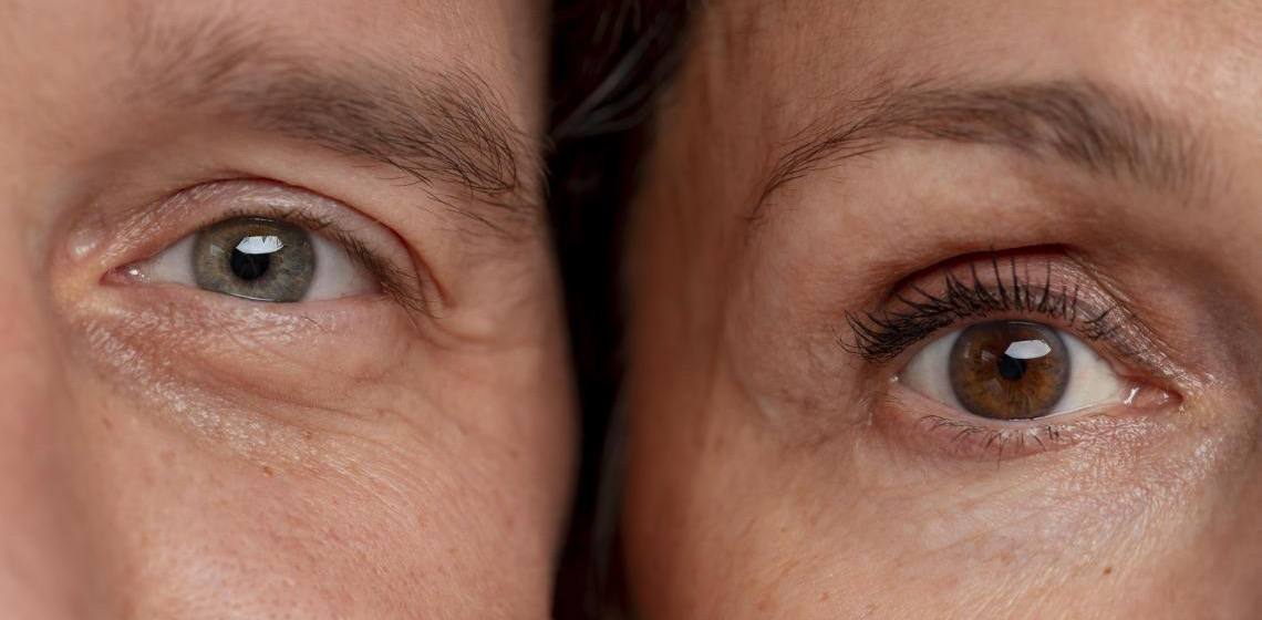 Saúde Ocular; Você sabe quais os principais sintomas de doenças oculares?