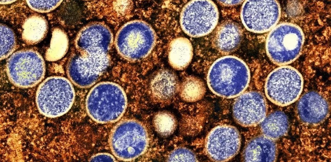 OMS declara mpox como emergência em saúde pública global; saiba o que isso significa