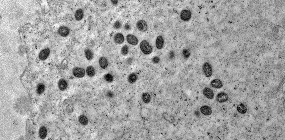 Mpox: Autoridades da Argentina põe em quarentena navio que deixou Brasil