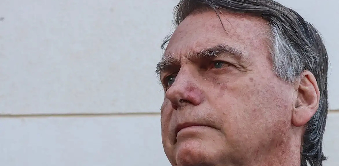 Por Matheus Leitão: Bolsonaro prova do próprio veneno
