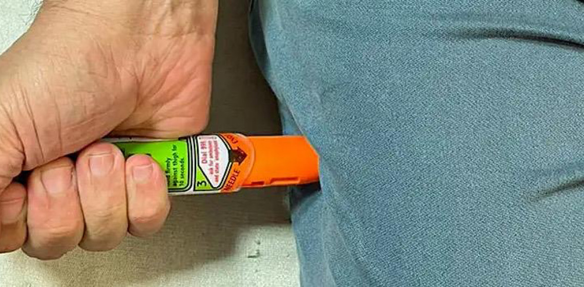 Alergia grave: pesquisadores criam 1ª caneta de adrenalina brasileira 