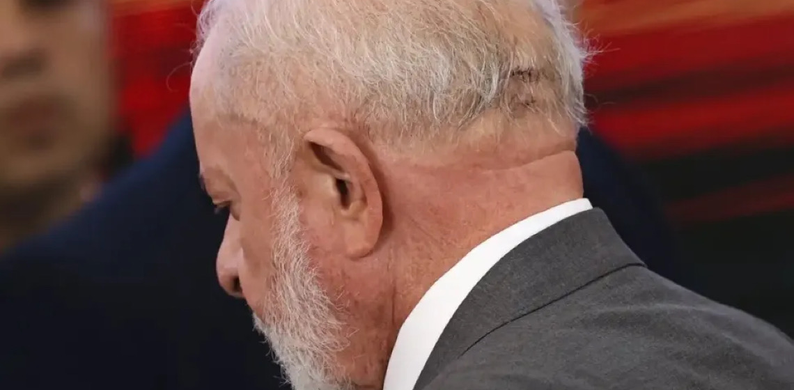Lula vai passar por novo procedimento cirúrgico para bloquear fluxo de sangue no cérebro