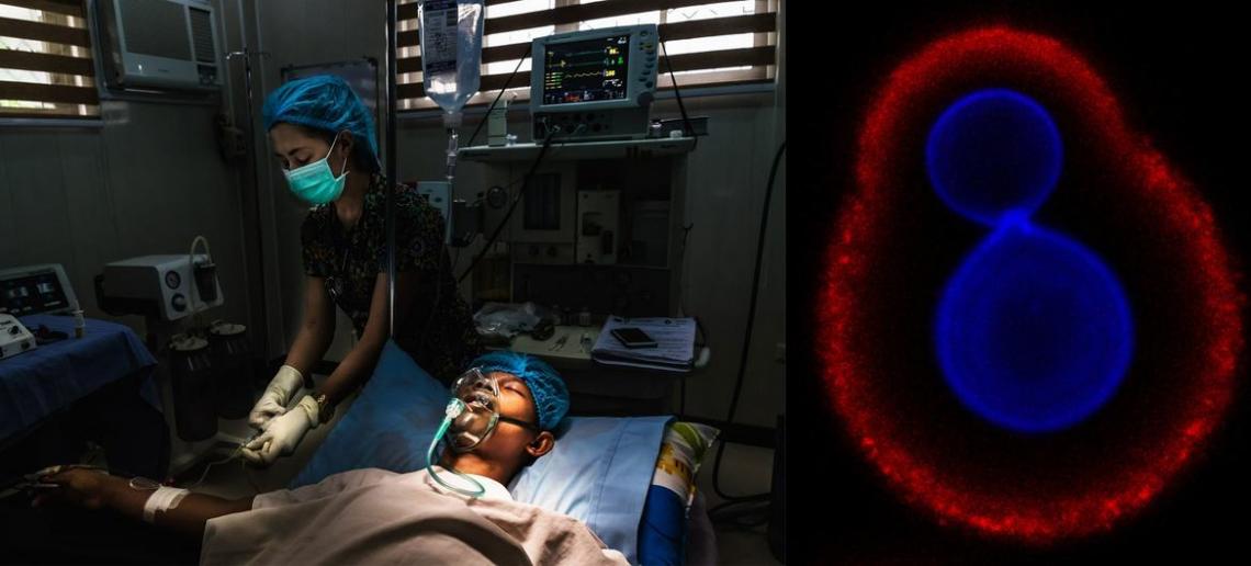 OMS soa alarme sobre falta de ferramentas para combater infecções por fungos