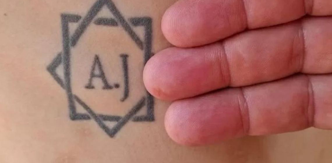 Escravizado tatuado com iniciais do patrão pode receber R$ 1,3 milhão