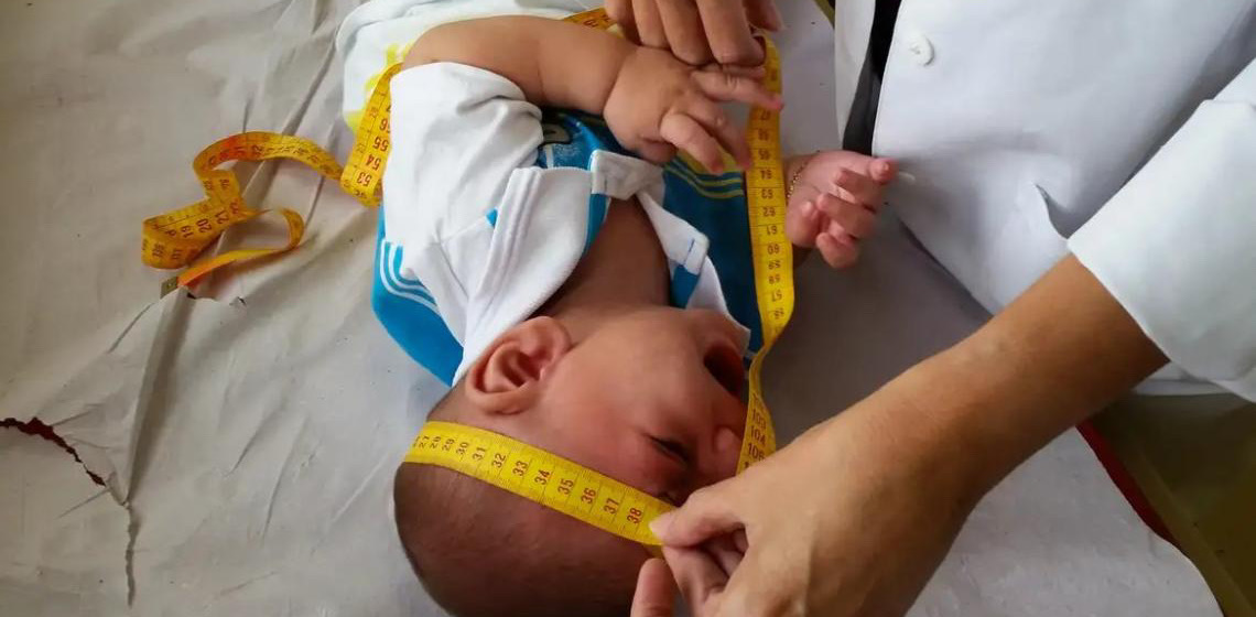 INSS pagará indenização de R$ 60 mil a crianças vítimas de zika