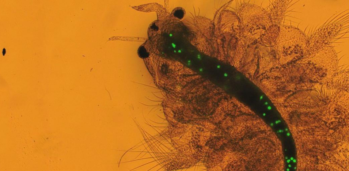 Entenda como microplásticos representam riscos à saúde das pessoas e do planeta