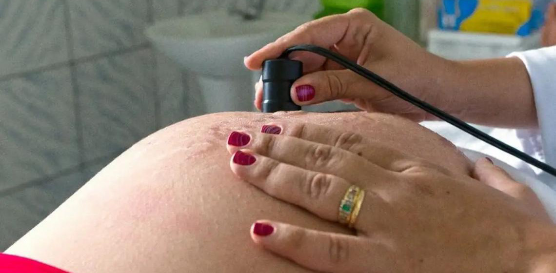 Pesquisa indica que exame pré-natal reduz chance de bebê nascer com anomalia
