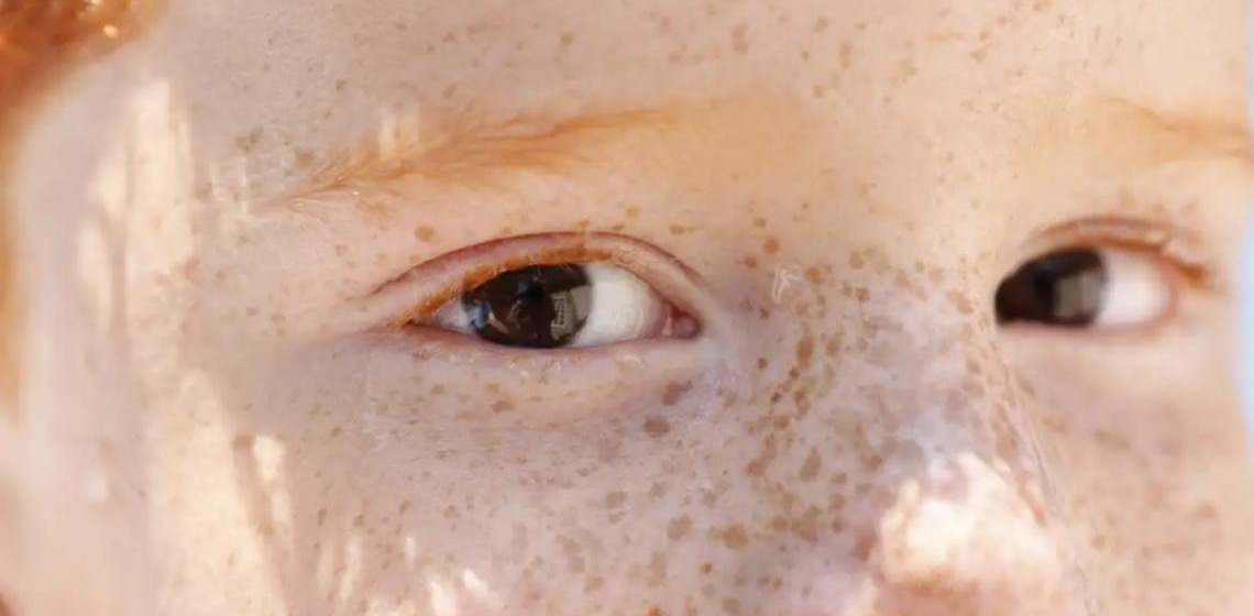 Reflexo branco nos olhos: Entenda condição que assusta pais