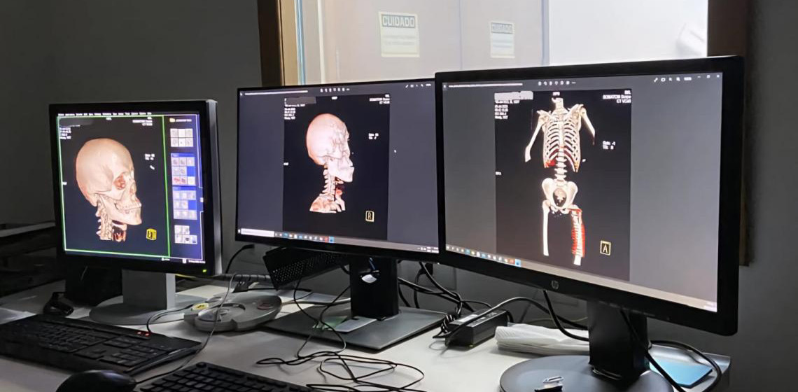 Policiais civis do Distrito Federal recebem treinamento em radiologia forense