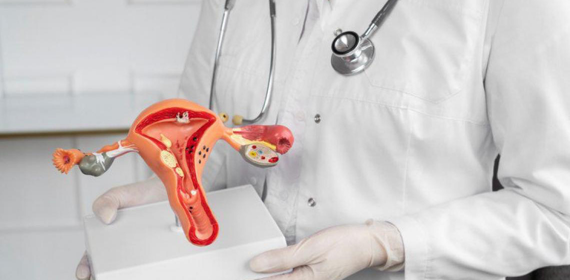 União amplia atendimento do SUS a mulheres com endometriose profunda