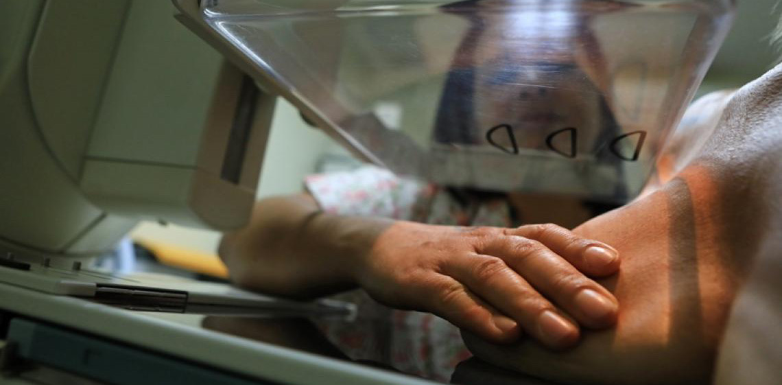 Número de mamografia cresce 21,8% na rede pública do Distrito Federal